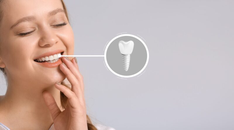 dental implants