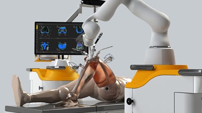 robotic knee replacement surgery