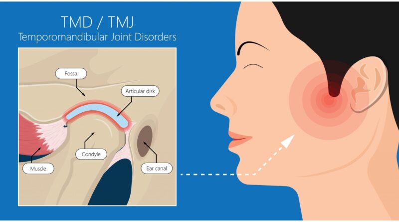 tmj treatment